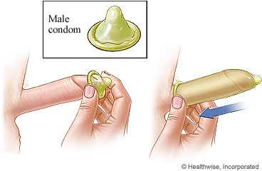 How do male condoms work?