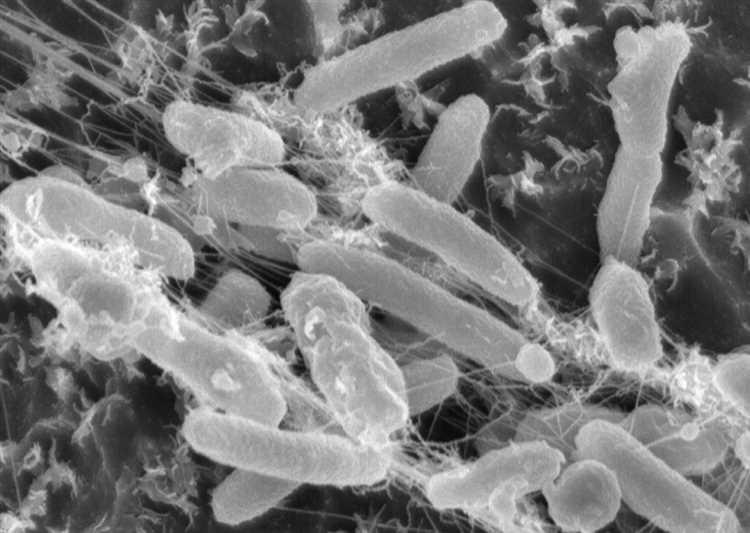 The Significance of Plastic Degrading Microbes in Environmental Conservation